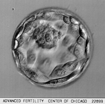 Human blasocyst